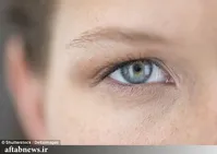 ۴ تغییر مهم در چهره که نشان‌دهنده خطر برای سلامتی هستند